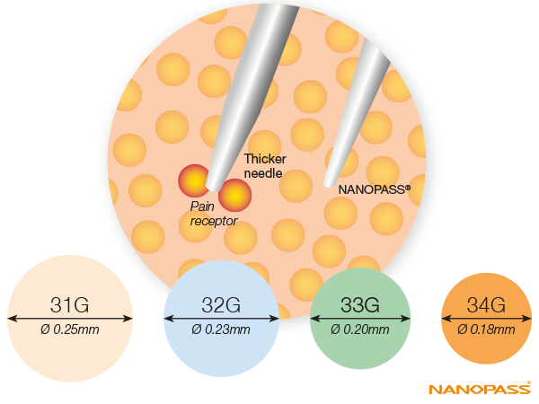 Nanopassᵀᴹ 34G Needle for pen injectors